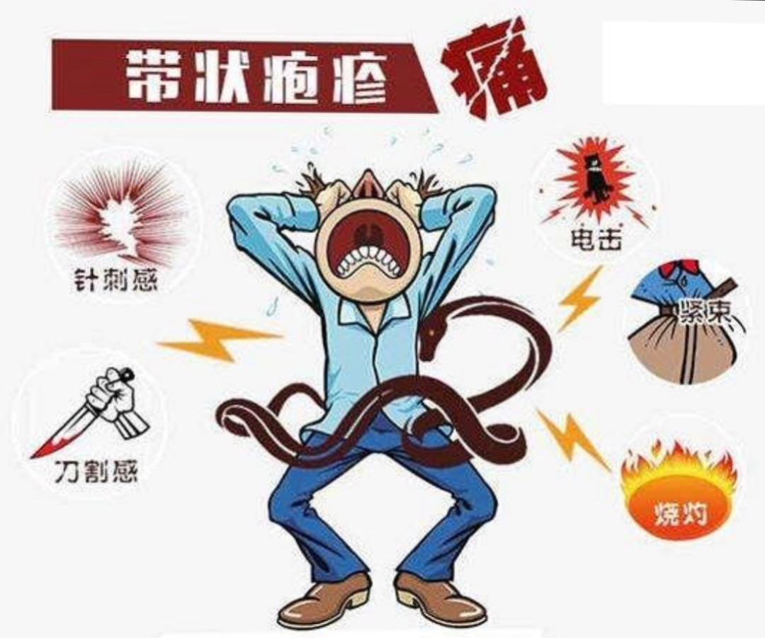 【健康科普】当心“蛇缠腰”——带状疱疹